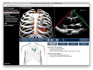 screen capture of Virtual TTE FOCUS module